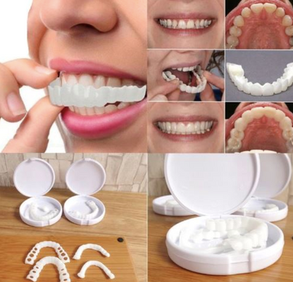 Carillas Dentales Premium - HappySmile 🦷