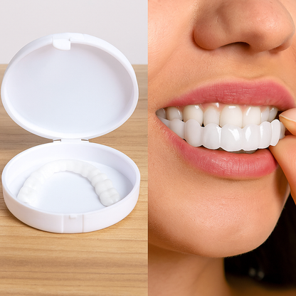 Carillas Dentales Premium - HappySmile 🦷
